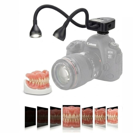 Dual LED Lighting for Dental Photography – Compatible with All Camera Models | Adjustable Brightness in 10 Levels